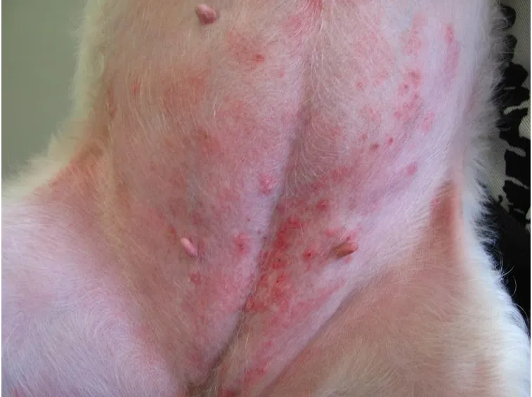 dermatite atopica