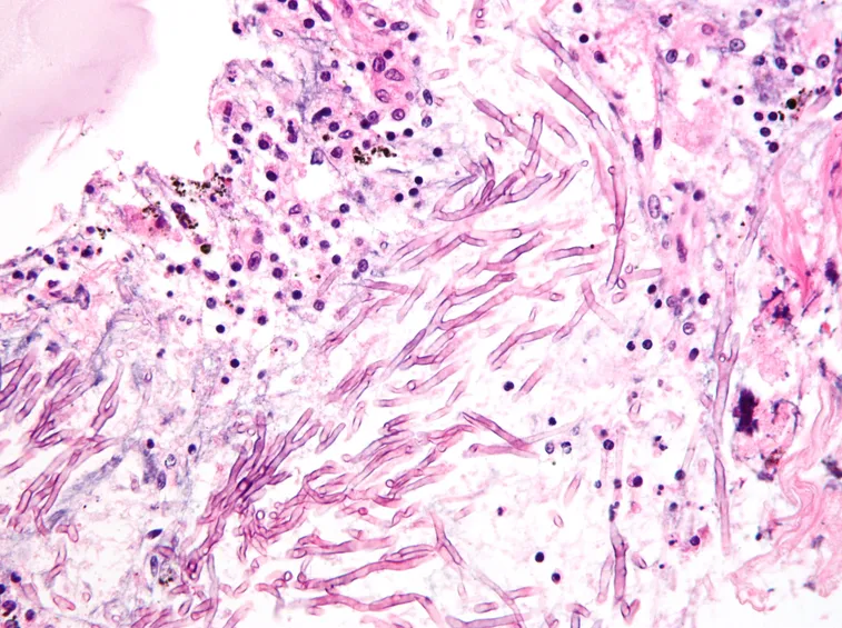 Esempio di micosi del cane al microscopio