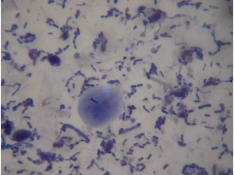 Parassiti che originano la giardia