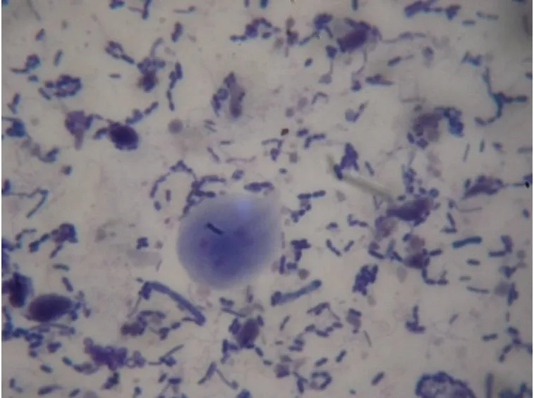 Parassiti della giardia